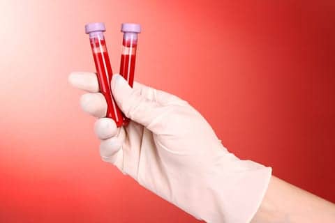 New Test Allows Simultaneous Detection of up to 22 Respiratory Pathogens