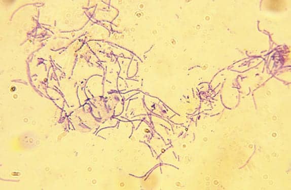 Anthrax Vaccine Approved for Postexposure Protection